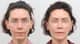 Slider image (6) AB Plastic Surgery